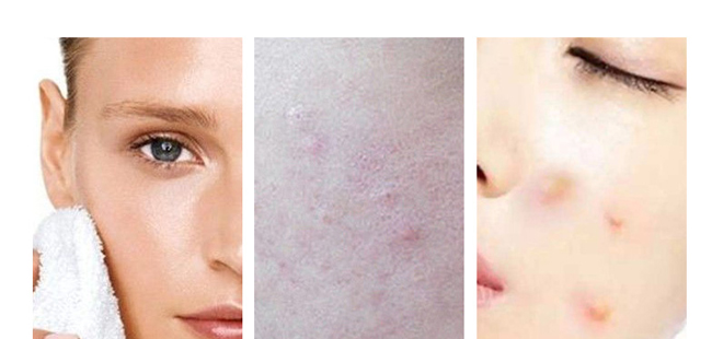 Ԋ��������r����͸������y��ĭ